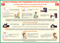Таблица "Порядок действий при опасном кровотечении" (100х140 сантиметров, винил) - fgospostavki.ru - Вологда