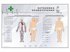 Электрифицированный стенд "Остановка кровотечения" - fgospostavki.ru - Вологда