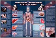 Электрифицированный стенд "Вредные привычки: алкоголизм" - fgospostavki.ru - Вологда