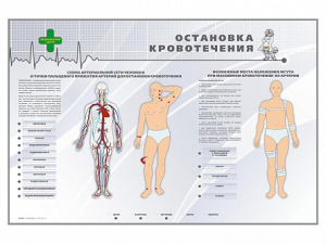Электрифицированный стенд "Остановка кровотечения" - fgospostavki.ru - Вологда