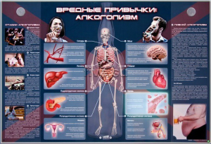 Электрифицированный стенд "Вредные привычки: алкоголизм" - fgospostavki.ru - Вологда